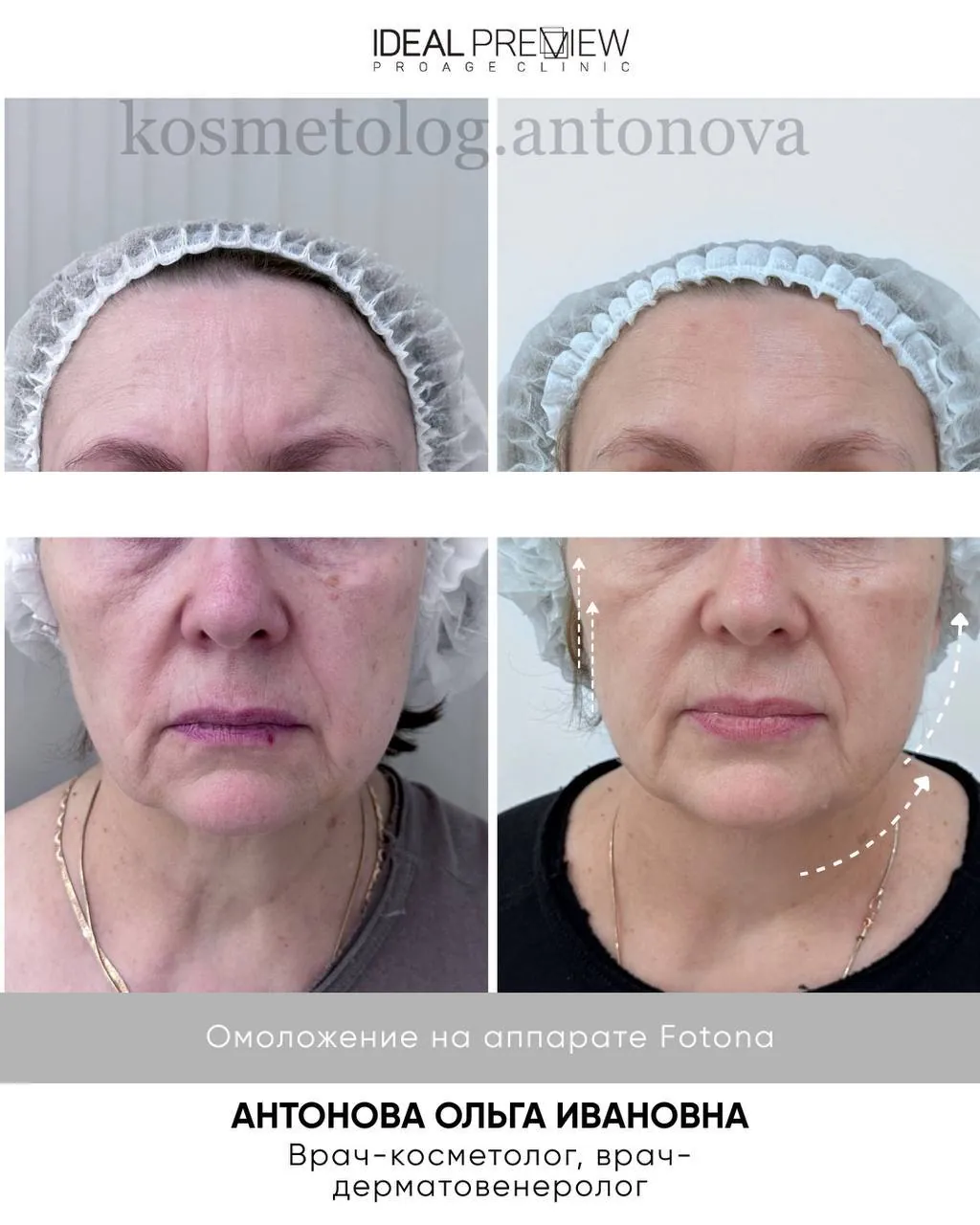 Результат работы — Антонова Ольга Ивановна