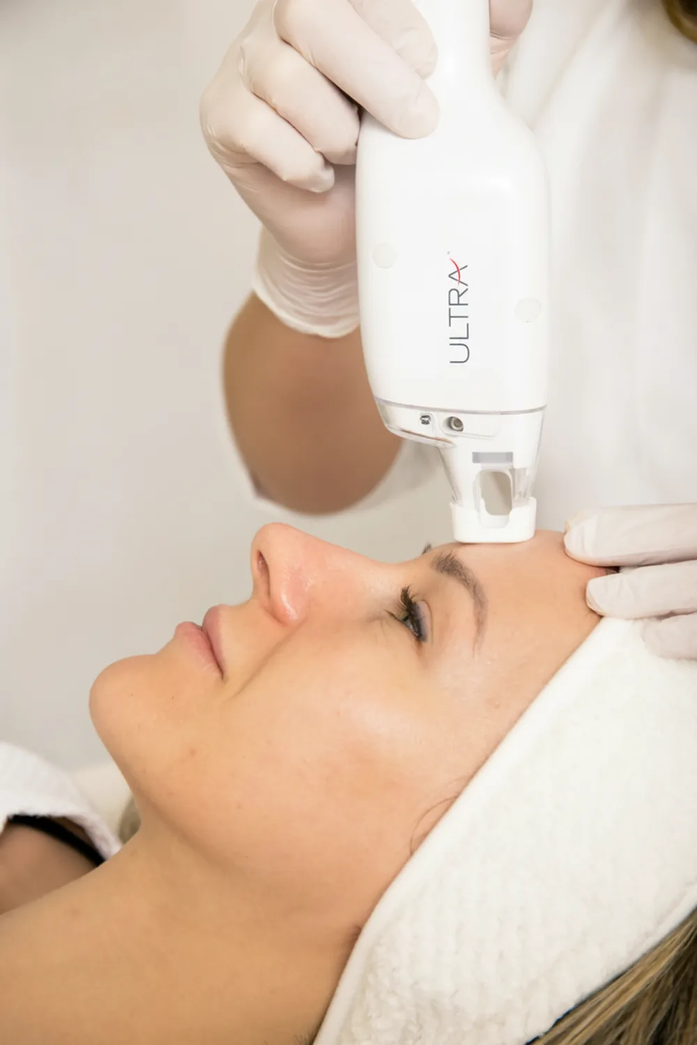 Процедура LaseMD ULTRA в IDEAL CLINIC