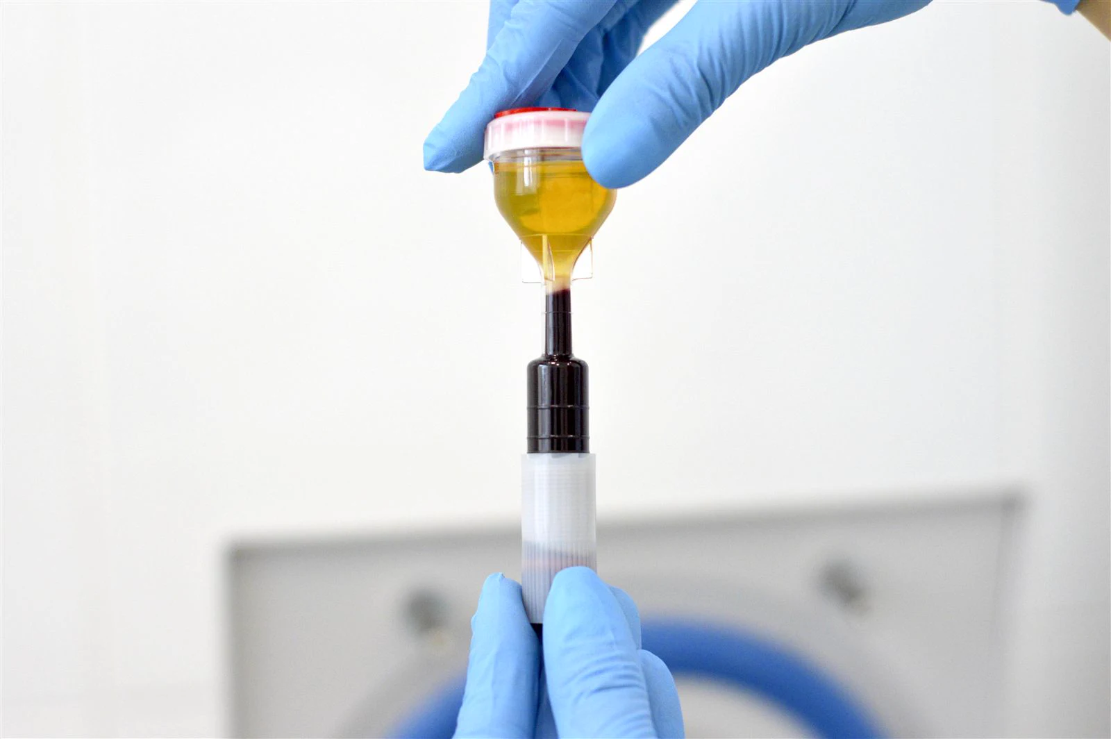 Разделение плазмы крови в пробирке RegenLab